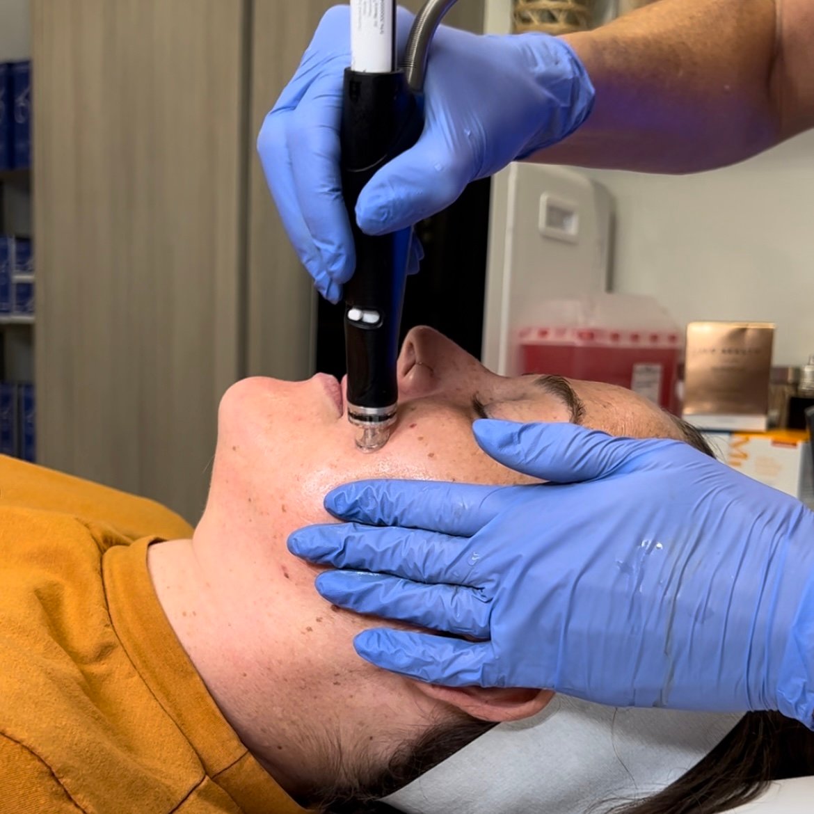 Hydrafacial at Cyrus Cosmetics